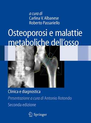 Osteoporosi e malattie metaboliche dell'osso: Clinica e diagnostica de Carlina V. Albanese