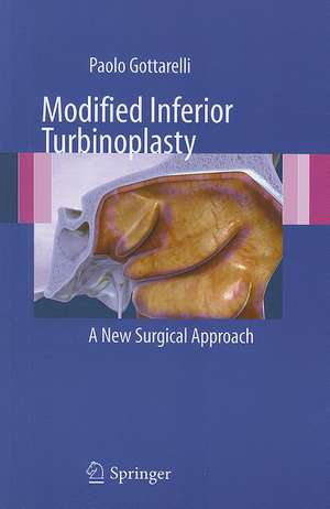 Modified Inferior Turbinoplasty: A new surgical approach de Paolo Gottarelli