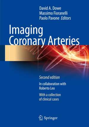 Imaging Coronary Arteries de David A. Dowe