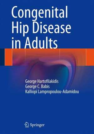 Congenital Hip Disease in Adults de George Hartofilakidis