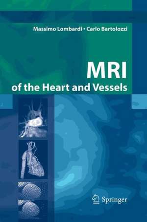 MRI of the Heart and Vessels de Massimo Lombardi