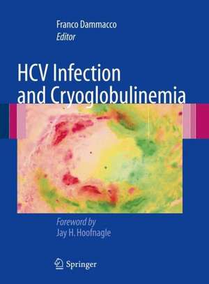 HCV Infection and Cryoglobulinemia de Franco Dammacco