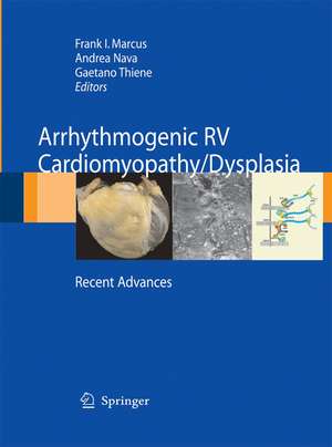 Arrhythmogenic RV Cardiomyopathy/Dysplasia: Recent Advances de Frank I. Marcus