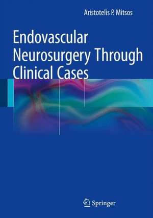 Endovascular Neurosurgery Through Clinical Cases de Aristotelis P. Mitsos