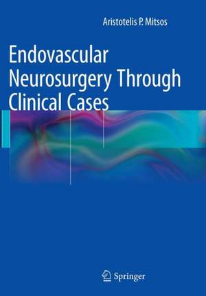 Endovascular Neurosurgery Through Clinical Cases de Aristotelis P. Mitsos