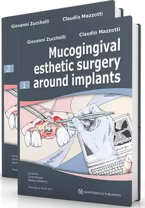 Mucogingival Esthetic Surgery Around Implants de Giovanni Zucchelli