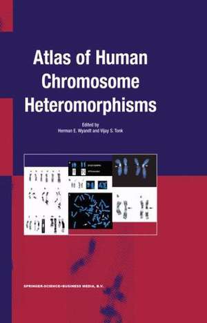 Atlas of Human Chromosome Heteromorphisms de H.E. Wyandt