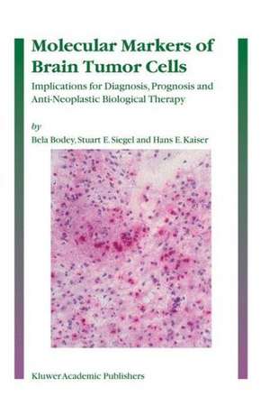 Molecular Markers of Brain Tumor Cells: Implications for Diagnosis, Prognosis and Anti-Neoplastic Biological Therapy de Bela Bodey