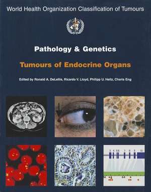 Pathology and Genetics of Tumours of Endocrine Organs de Iarc