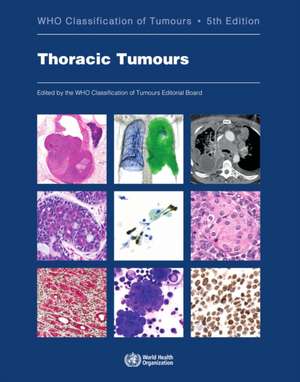 Thoracic Tumours de Who Classification of Tumours Editorial Board