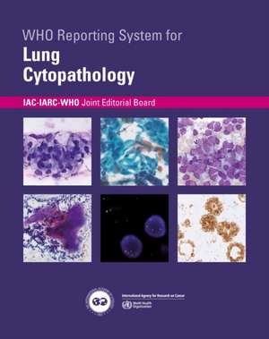 Who Reporting System for Lung Cytopathology de Iac-Iarc-Who Joint Editorial Board