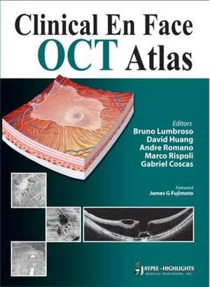 Clinical En Face OCT Atlas de Bruno Lumbroso