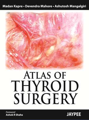 Atlas of Thyroid Surgery de Madan Kapre