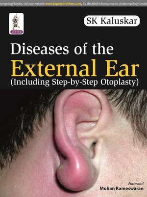 Diseases of the External Ear de SK Kaluskar