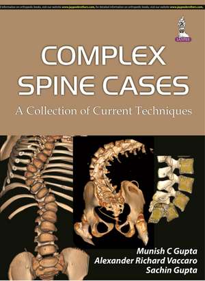 Complex Spine Cases: A Collection of Current Techniques de Munish C Gupta