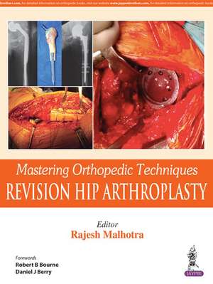 Mastering Orthopedic Techniques: Revision Total Hip Arthroplasty de Rajesh Malhotra