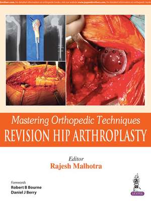 Mastering Orthopedic Techniques de Rajesh Malhotra
