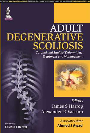 Adult Degenerative Scoliosis de James S Harrop