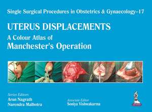 Single Surgical Procedures in Obstetrics and Gynaecology – 17 - UTERUS DISPLACEMENTS: A Colour Atlas of Manchester's Operation de Arun Nagrath