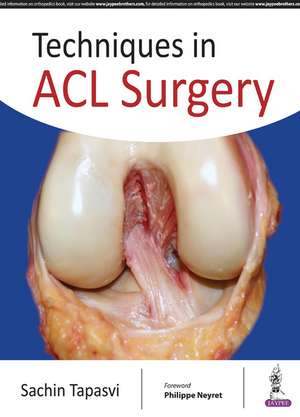 Techniques in ACL Surgery de Sachin Tapasvi