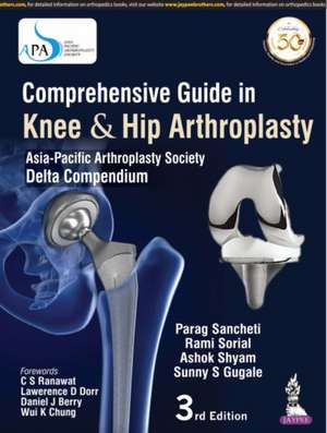 Comprehensive Guide in Knee & Hip Arthroplasty de Parag Sancheti