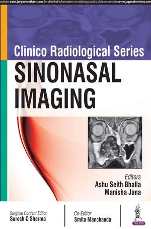 Clinico Radiological Series: Sinonasal Imaging de Ashu Seith Bhalla