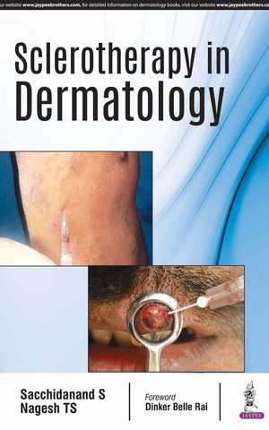 Sclerotherapy in Dermatology de Sacchidanand S