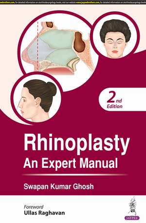 Rhinoplasty: An Expert Manual de Swapan Kumar Ghosh