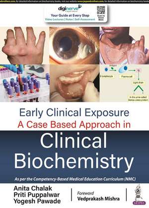 Early Clinical Exposure: A Case Based Approach in Clinical Biochemistry de Anita Chalak (Kale)