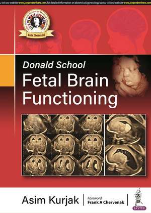 Donald School Fetal Brain Functioning de Asim Kurjak