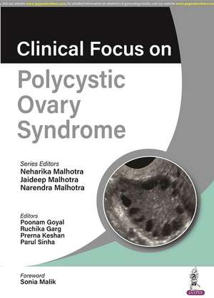 Clinical Focus on Polycystic Ovary Syndrome de Neharika Malhotra