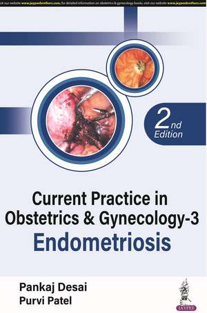 Current Practice in Obstetrics & Gynecology - 3: Endometriosis de Pankaj Desai