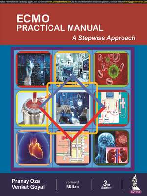 ECMO Practical Manual: A Stepwise Approach de Pranay Oza