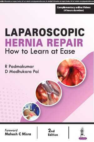 Laparoscopic Hernia Repair: How to Learn at Ease de R Padmakumar