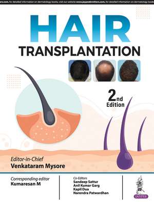 Hair Transplantation de Venkataram Mysore