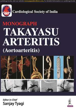 Takayasu Arteritis (Aortoarteritis) de Sanjay Tyagi