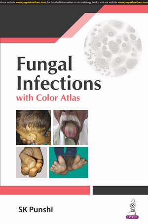 Fungal Infections: with Color Atlas de SK Punshi