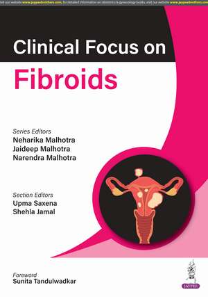 Clinical Focus on Fibroids de Neharika Malhotra