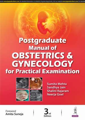 Postgraduate Manual of Obstetrics and Gynecology for Practical Examination de Sumita Mehta