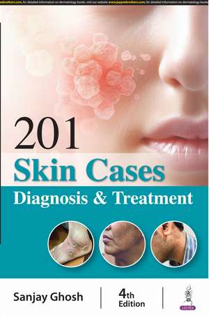 201 Skin Cases: Diagnosis & Treatment de Sanjay Ghosh