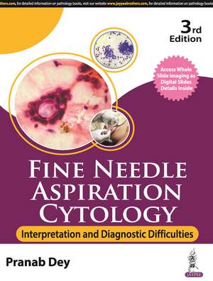 Fine Needle Aspiration Cytology: Interpretation and Diagnostic Difficulties de Pranab Dey