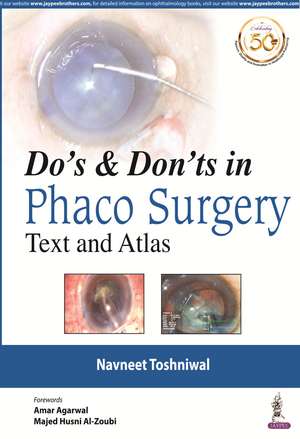 Do's & Dont's in Phaco Surgery: Text and Atlas de Navneet Toshniwal