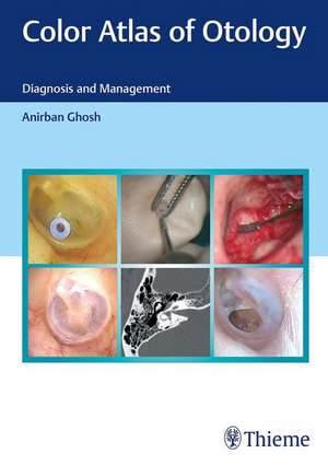 Color Atlas of Otology – Diagnosis and Management de A Ghosh