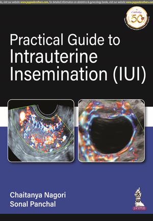 Practical Guide to Intrauterine Insemination (IUI) de Chaitanya Nagori