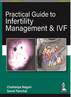 Practical Guide to Infertility Management & IVF de Chaitanya Nagori