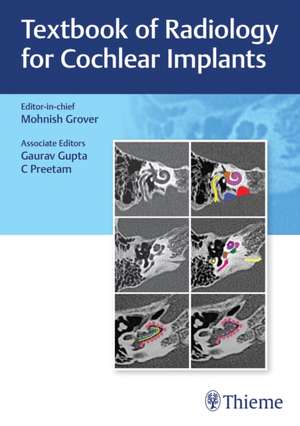 Textbook of Radiology for Cochlear Implants de Mohnish Grover