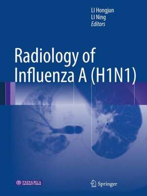 Radiology of Influenza A (H1N1) de Hongjun Li