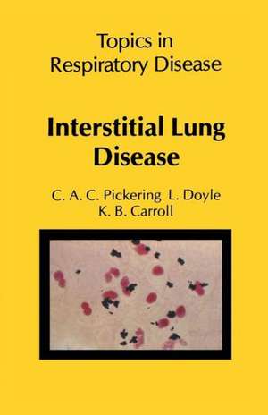 Interstitial Lung Disease de C. A. C. Pickering