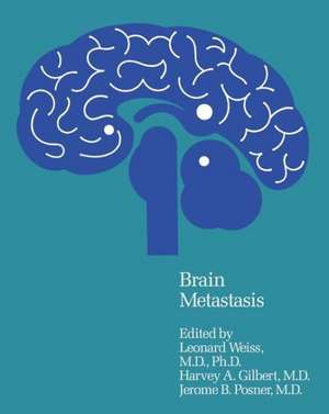 Brain Metastasis de L. Weiss