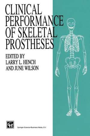 Clinical Performance of Skeletal Prostheses de J. Wilson